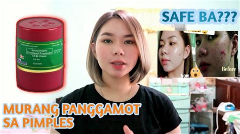 SABON NA PANGTANGGAL NG PIMPLES .